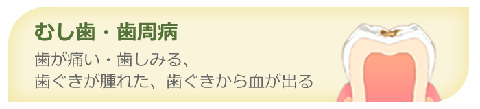 虫歯・歯周病 - 歯が痛い・歯がしみる・歯ぐきが腫れた・歯ぐきから血が出る